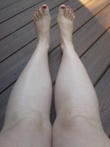 My legs as of 18-Sept-2015