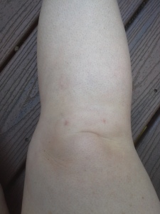 Close-up of my right knee